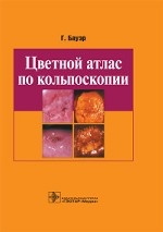 Цветной атлас по кольпоскопии