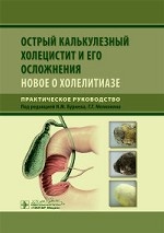 Острый калькулезный холецистит и его осложнения. Новое о холелитиазе