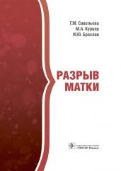 Галина Савельева: Разрыв матки