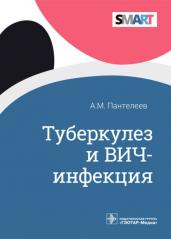 Туберкулез и ВИЧ-инфекция