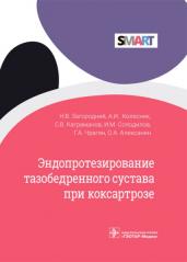 Эндопротезирование тазобедренного сустава при коксартрозе