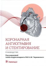 Коронарная ангиография и стентирование.Руководство